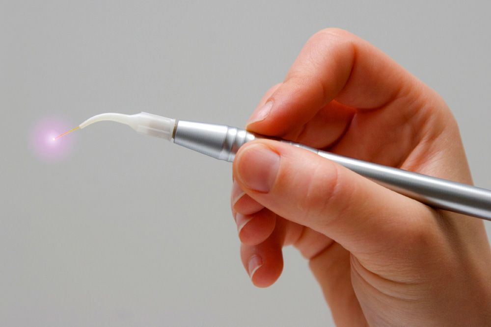 A handheld dental laser